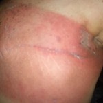 Radiation-Day-33-150x150